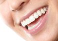 are dental veneers permanent blog